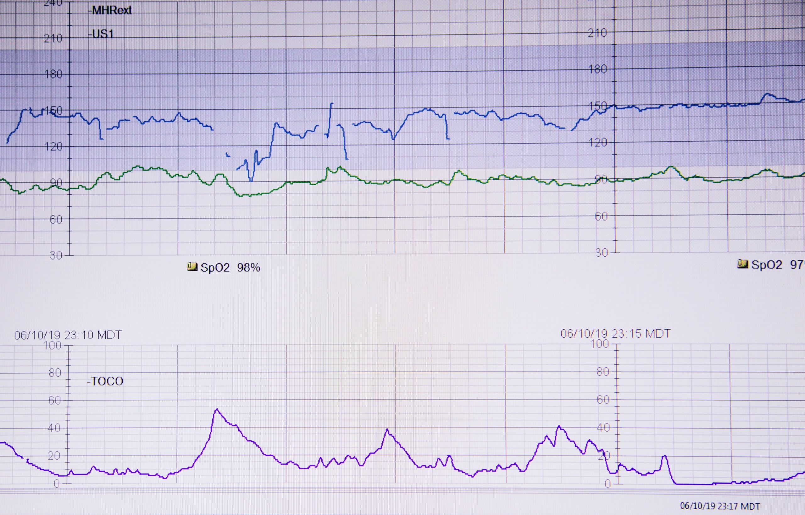 IP2 Network: Secure Data Exchange in Healthcare