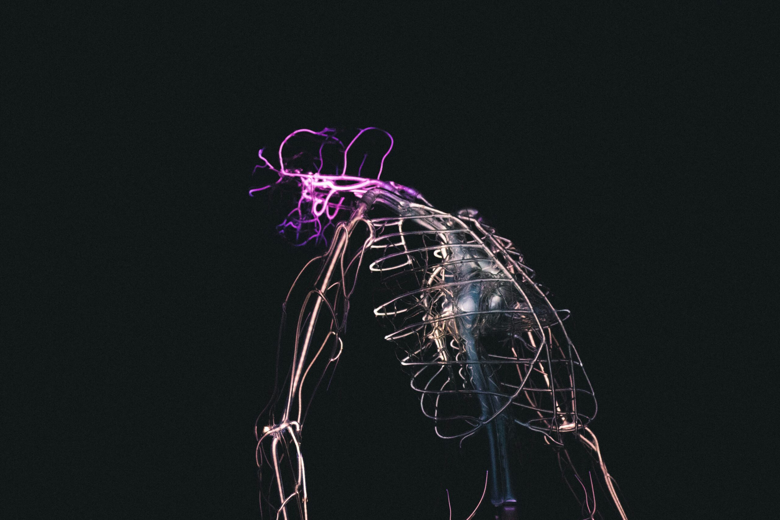 Inomyalgia: An Overlooked Musculoskeletal Condition
